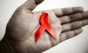 aids 3