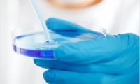 analisi liquido azzurro