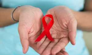 hiv rosso