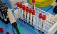 lab analisi