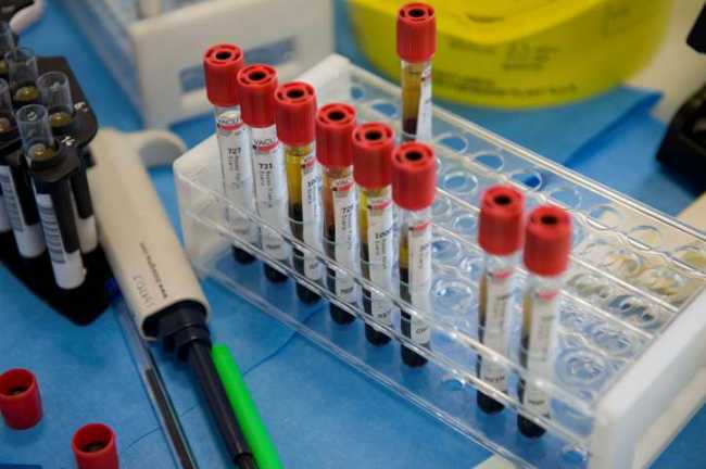 lab analisi
