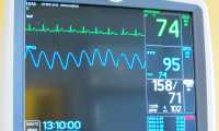 monitor cardiologia