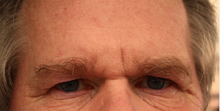 "Lo stalking (atti persecutori)", nuovo editoriale di Carlo Crapanzano