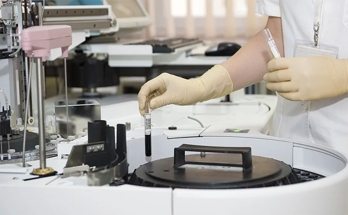 Salgono a 5 i positivi al primo test del coronavirus nel Vco, 81 in Piemonte