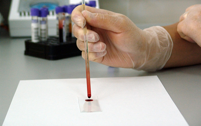 Coronavirus, tre casi probabili a Novara. Positivo il primo test, si attende convalida