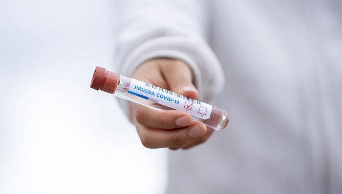 Da lunedì 12 hotspot in Piemonte per i tamponi rapidi