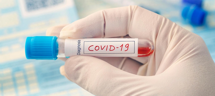 Test sierologici Covid-19 sui vigili del fuoco