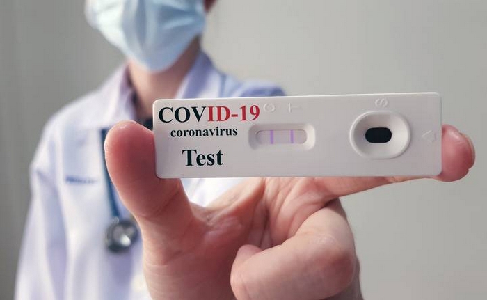 Verbania civica: nella fase-2 test sierologici a tappeto 