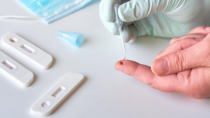 Alla farmacia comunale il test sierologico rapido
