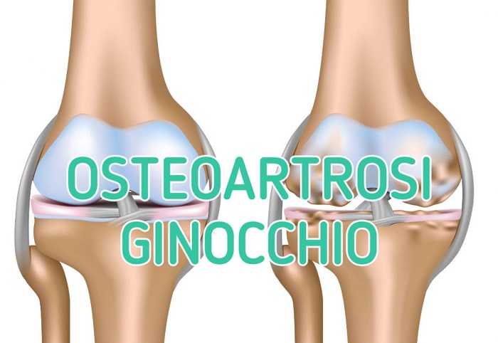 Al dottor Alberto Gallo il compito di chiudere gli incontri sulla salute a Omegna