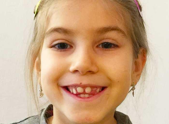 Il cervo Gustavo ferisce un padre con una bambina, si erano avvicinati troppo
